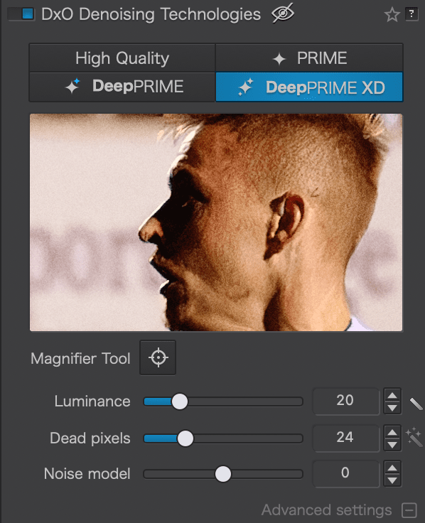 Screenshot of DeepPrime settings for test